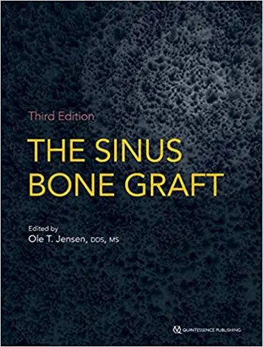 The Sinus Bone Graft, Third Edition