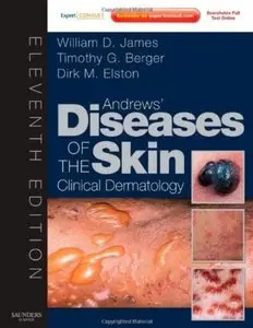 Andrews' Diseases of the Skin: Clinical Dermatology (11th edition) [Repost]