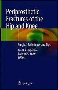 Periprosthetic Fractures of the Hip and Knee: Surgical Techniques and Tips