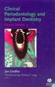 Jan Lindhe, Clinical Periodontology and Implant Dentistry (Repost) 