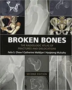 Broken Bones: The Radiologic Atlas of Fractures and Dislocations Ed 2