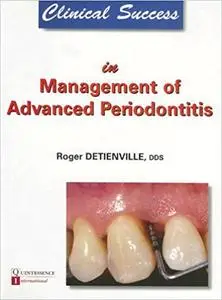 Clinical Success in Management of Advanced Periodontitis