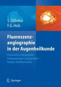 Fluoreszenzangiographie in der Augenheilkunde (Repost)