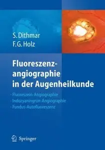 Fluoreszenzangiographie in der Augenheilkunde (Repost)