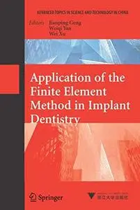 Application of the finite element method in implant dentistry