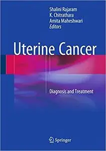 Uterine Cancer: Diagnosis and Treatment (repost)