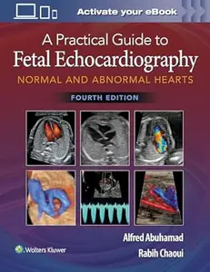 A Practical Guide to Fetal Echocardiography (4th Edition)