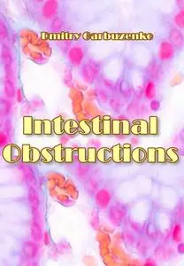 "Intestinal Obstructions" ed. by Dmitry Garbuzenko