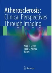 Atherosclerosis: Clinical Perspectives Through Imaging [Repost]