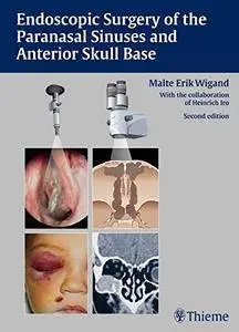 Endoscopic Surgery of the Paranasal Sinuses and Anterior Skull Base, 2 edition