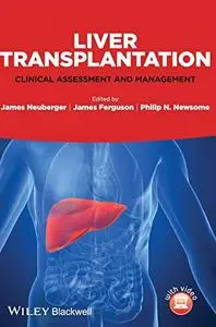 Liver Transplantation: Clinical Assessment and Management