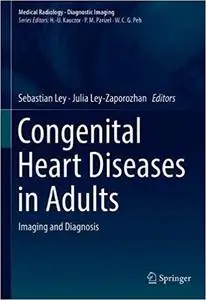 Congenital Heart Diseases in Adults: Imaging and Diagnosis