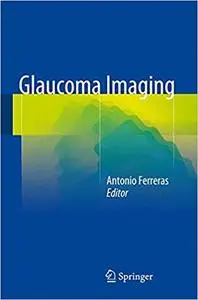 Glaucoma Imaging