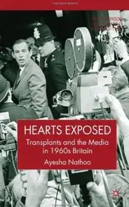 Hearts Exposed: Transplants and the Media in 1960s Britain [Repost]