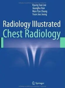 Radiology Illustrated: Chest Radiology [Repost]