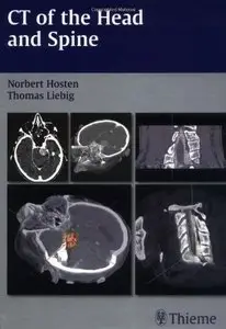 CT of the Head and Spine (repost)