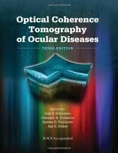 Optical Coherence Tomography of Ocular Diseases(Repost)