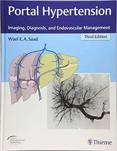 Portal Hypertension Imaging, Diagnosis, and Endovascular Management
