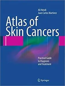 Atlas of Skin Cancers: Practical Guide to Diagnosis and Treatment (Repost)