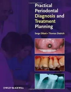 Practical Periodontal Diagnosis and Treatment Planning