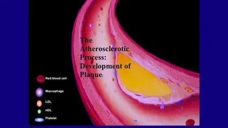 Steven Masley,MD - The 30-Day Heart Tune-Up Deluxe