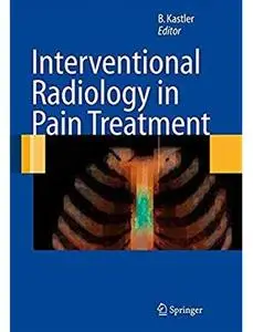 Interventional Radiology in Pain Treatment [Repost]