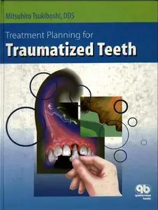 Treatment Planning for Traumatized Teeth by Mitsuhir Tsukiboshi