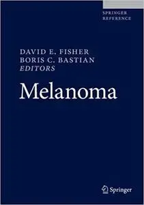 Melanoma