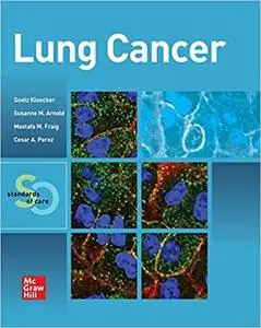 Lung Cancer: Standards of Care