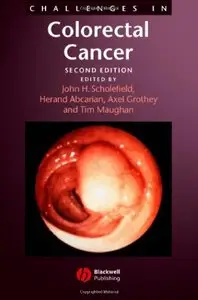 Challenges in Colorectal Cancer  [Repost]