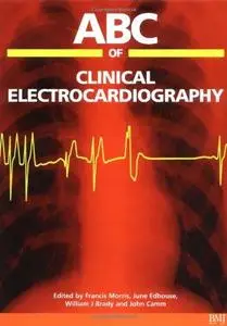 ABC of Clinical Electrocardiography