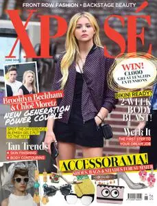 Xposé – 20 May 2016