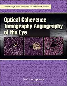 Optical Coherence Tomography Angiography of the Eye: OCT Angiography