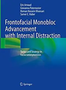 Frontofacial Monobloc Advancement with Internal Distraction