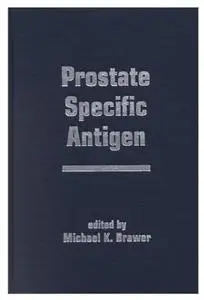 Prostate Specific Antigen [Repost]