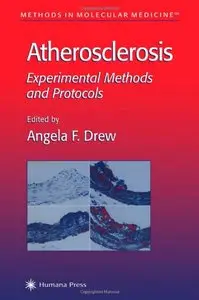 Atherosclerosis: Experimental Methods and Protocols (Methods in Molecular Medicine) by Angela F. Drew
