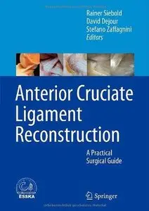 Anterior Cruciate Ligament Reconstruction: A Practical Surgical Guide (Repost)