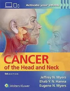 Cancer of the Head and Neck (Repost)