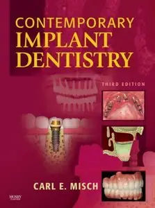 Contemporary Implant Dentistry, 3e (repost)