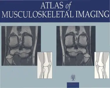 Atlas of Musculoskeletal Imaging