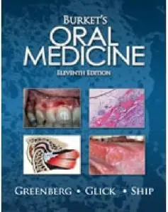 Burket's Oral Medicine, 11th Edition (Repost)