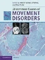 Uncommon Causes of Movement Disorders