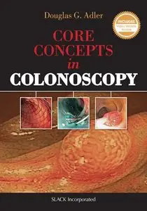 Core Concepts in Colonoscopy (repost)