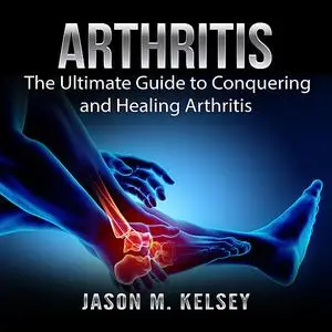 «Arthritis: The Ultimate Guide to Conquering and Healing Arthritis» by Jason M. Kelsey