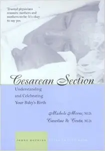 Cesarean Section: Understanding and Celebrating Your Baby's Birth