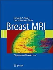 Breast MRI: Diagnosis and Intervention (Repost)