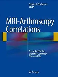 MRI-Arthroscopy Correlations: A Case-Based Atlas of the Knee, Shoulder, Elbow and Hip (Repost)