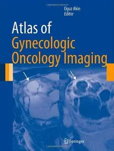 Atlas of Gynecologic Oncology Imaging (Atlas of Oncology Imaging)