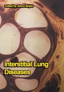 "Interstitial Lung Diseases" ed. by Jelena Stojšić
