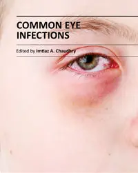 "Common Eye Infections" ed. by Imtiaz A. Chaudhry